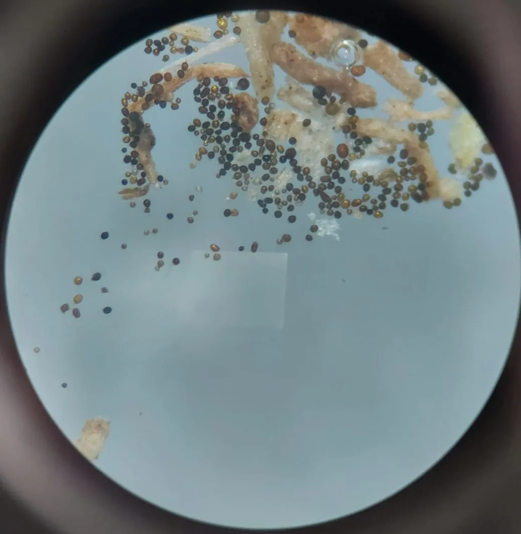 Esporos micorrízicos observados ao microscópio