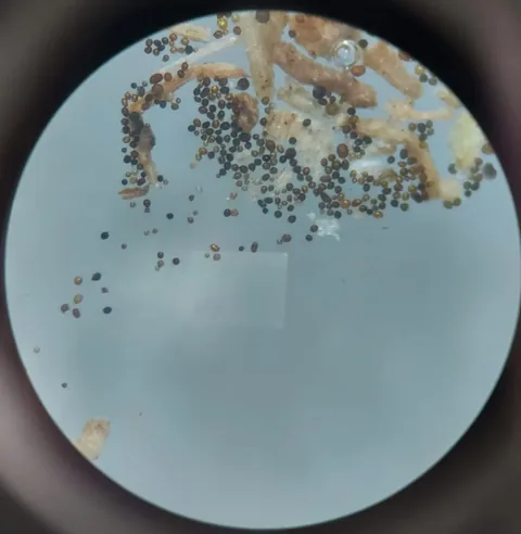 Esporos micorrízicos observados ao microscópio